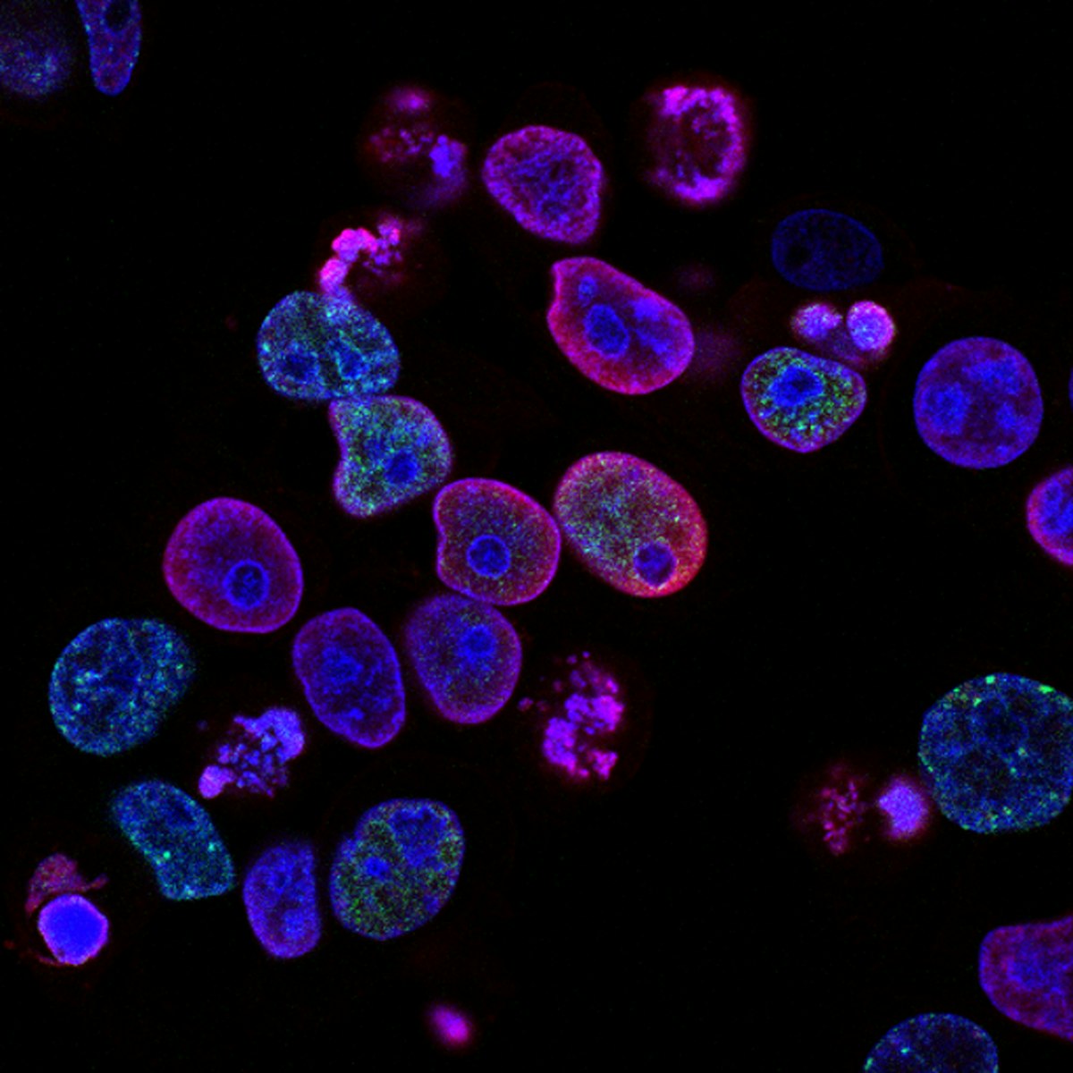 Large-Scale H. pylori Eradication Study Shows 40% Reduction in Gastric Cancer Risk